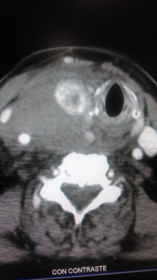 Casos de Radiología & Salud 1