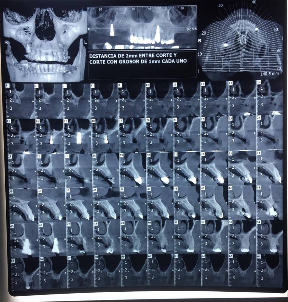 31957538_1594186530693914_900239142540017664_n